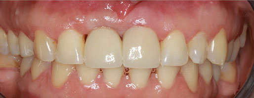 Cosmetic Dentist Trumbull CT