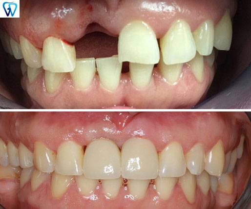 GD Dentistry | Dental Lab, Digital Radiography and Sinus Lift