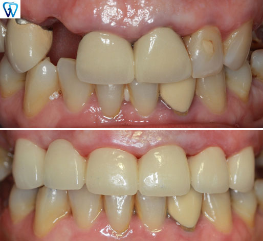 GD Dentistry | Digital Radiography, CBCT and Veneers