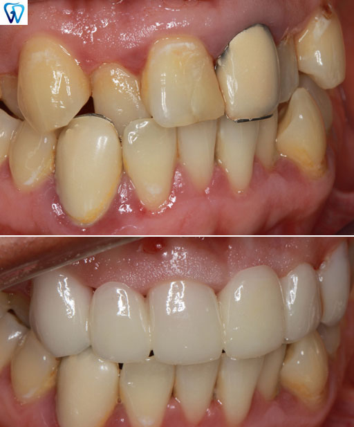 GD Dentistry | Oral Exams, Ceramic Crowns and CBCT