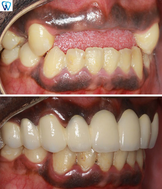 GD Dentistry | CBCT, Dental Fillings and Dental Bridges