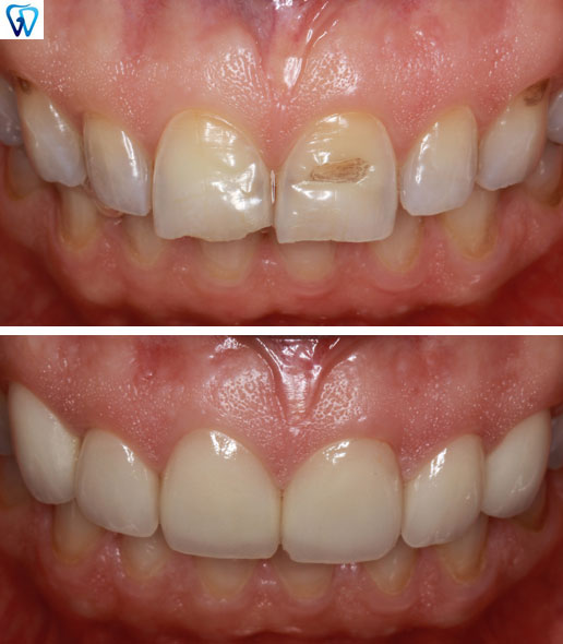 GD Dentistry | Cosmetic Dentistry, Emergency Treatment and Invisalign reg 