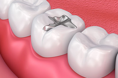 GD Dentistry | Dental Lab, CEREC reg  and Sinus Lift