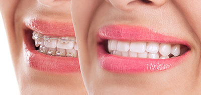GD Dentistry | Sinus Lift, CEREC reg  and CBCT