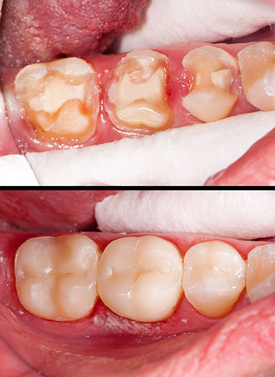 GD Dentistry | Emergency Treatment, Bone Graft and Dental Lab