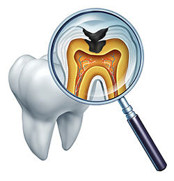 GD Dentistry | Night Guards, Preventative Program and ClearCorrect reg 