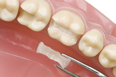 GD Dentistry | Dental Lab, Sedation Dentistry and Extractions