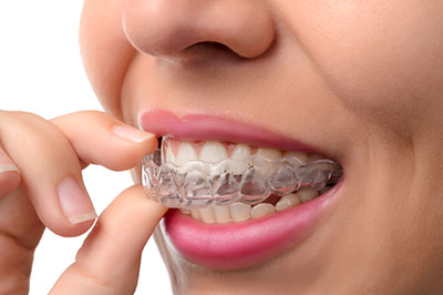 GD Dentistry | Periodontal Treatment, Bone Graft and Root Canals