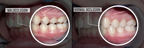 GD Dentistry | Sinus Lift, CBCT and Dentures