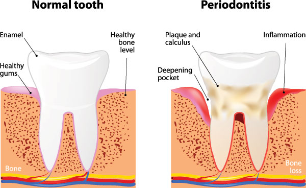 GD Dentistry | Sedation Dentistry, Periodontal Treatment and Veneers
