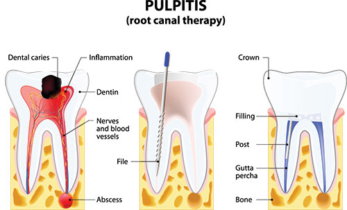 GD Dentistry | Periodontal Treatment, E4D and Teeth Whitening