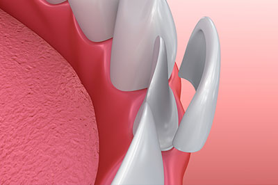GD Dentistry | Invisalign reg , Sedation Dentistry and Dental Lab