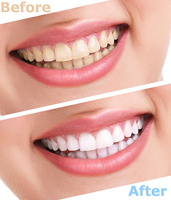 GD Dentistry | Oral Exams, Cosmetic Dentistry and Dental Fillings